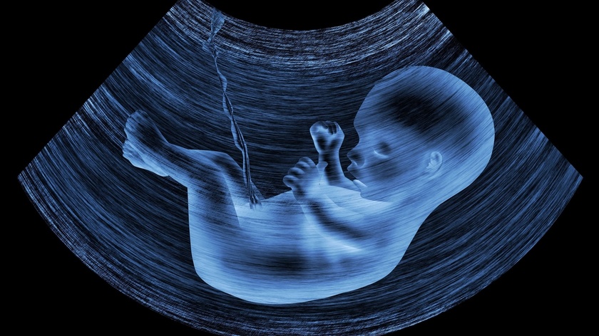 Interviu despre malformațiile congenitale apărut pe site-ul suntmamica.ro